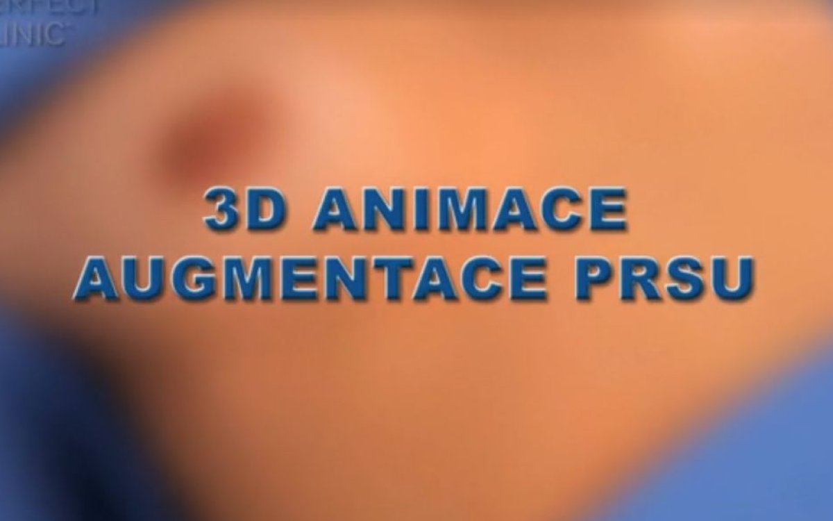 3D animace zvětšení prsou - step by step